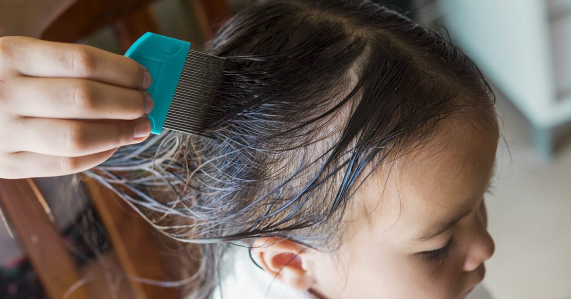 Chicago’s Lice Treatment and Lice Removal Service