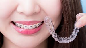 Invisalign: Uniting Aesthetic Brilliance with Oral Health Excellence